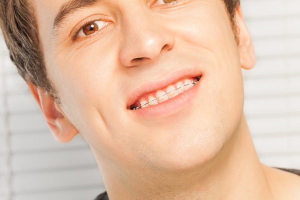 How To Maintain Your Oral Health With Clear Braces From A General Dentist