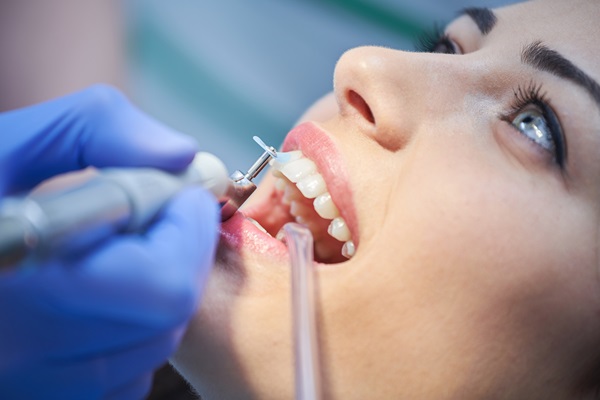 Benefits Of Regular General Dentistry Dental Cleanings