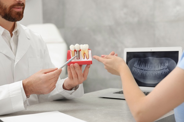 Proper Dental Implant Care In Your Oral Hygiene Routine