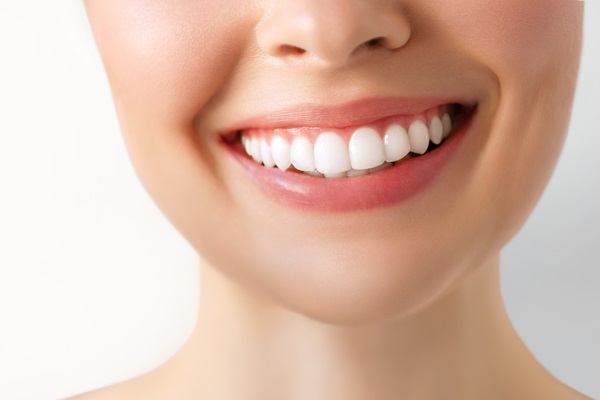 Choosing In Chair Or Take Home Teeth Whitening